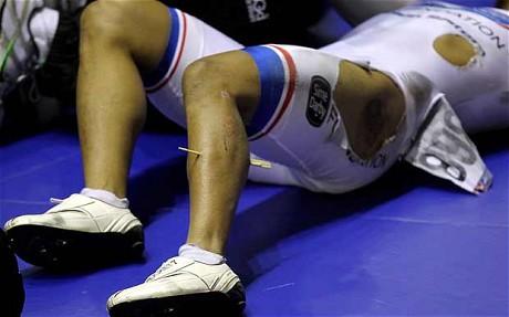 Azizulhasni-Awang-wood-splinter-2.jpg