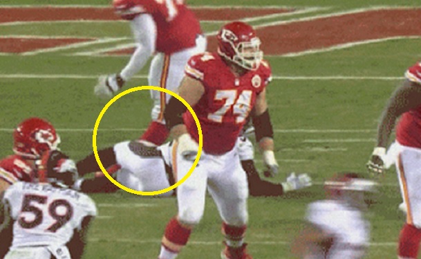 Watch Branden Albert's Knee Bend The Wrong Way (gif) 