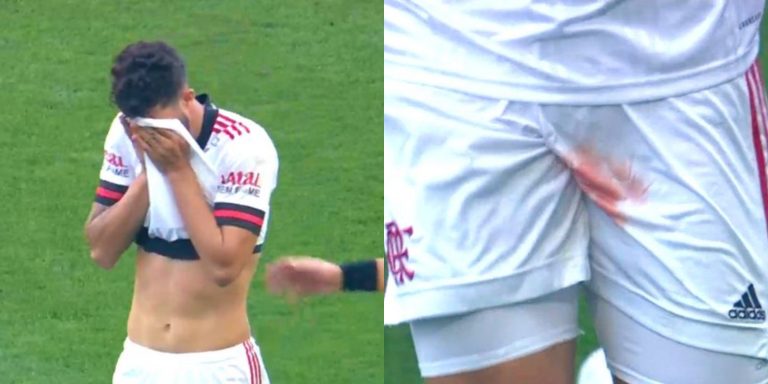 Soccer Player Suffers Horrific Testicle Injury After Being Stepped On Video