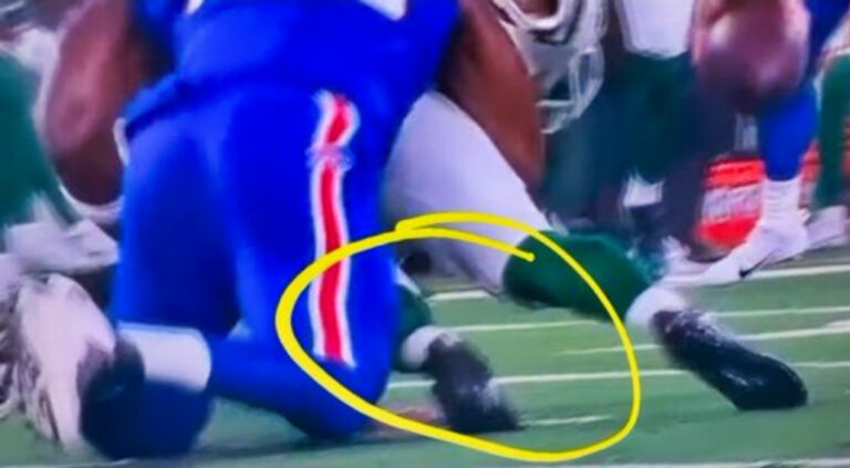 Gruesome Slo-Mo Video Shows Close-Up Of Aaron Rodgers’ Injury