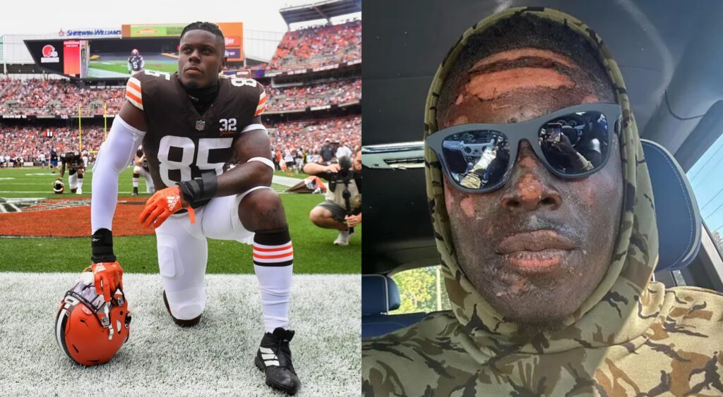 David Njoku on the field and a photo of his face after the burns.