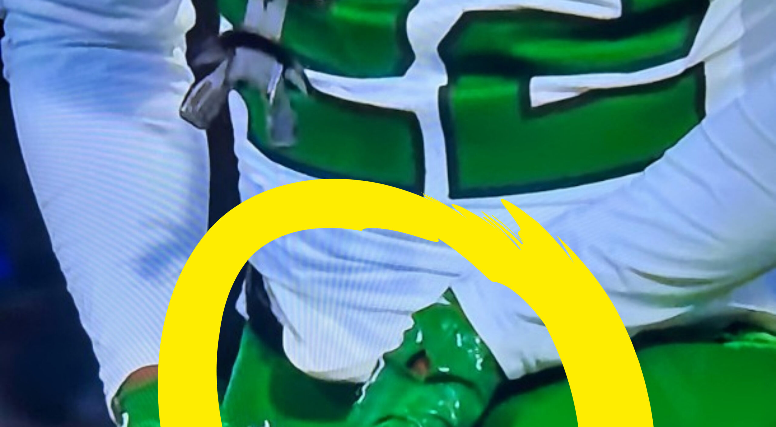 Jets DB Tony Adams Had Finger Bone Sticking Out Of His Skin