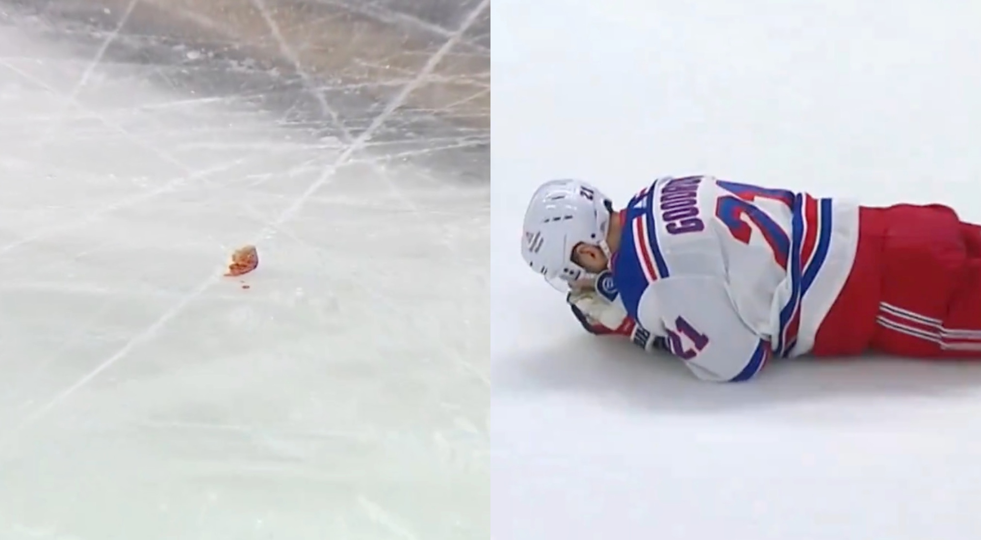 Rangers Player Spits Out Tooth After Taking Puck To Face