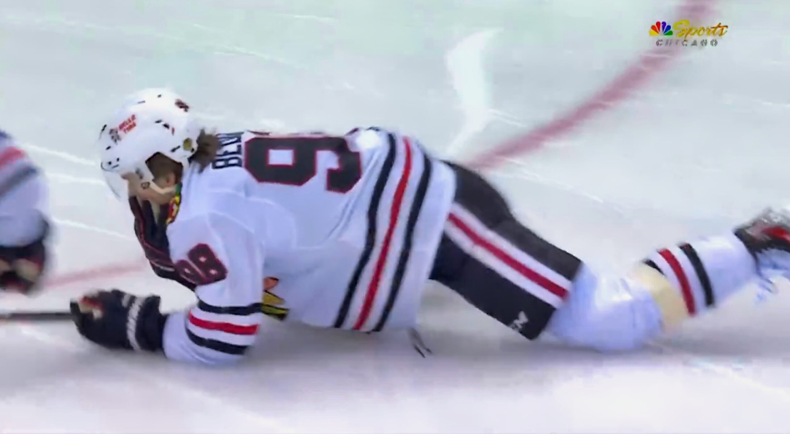 Blackhawks Connor Bedard Suffered Fractured Jaw On A Brutal Hit