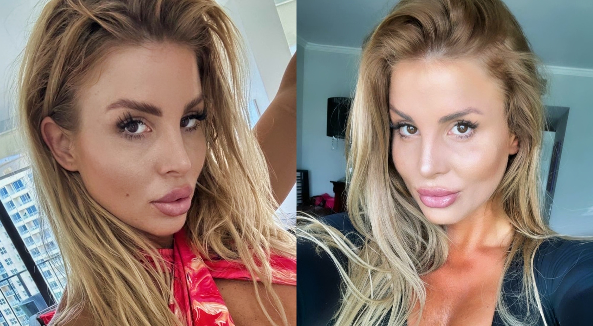 VIDEO: Social Media Is Going Crazy After Powerslap Star Sheena Bathory  Posts Her Brazilian Backside Lift Surgery Results