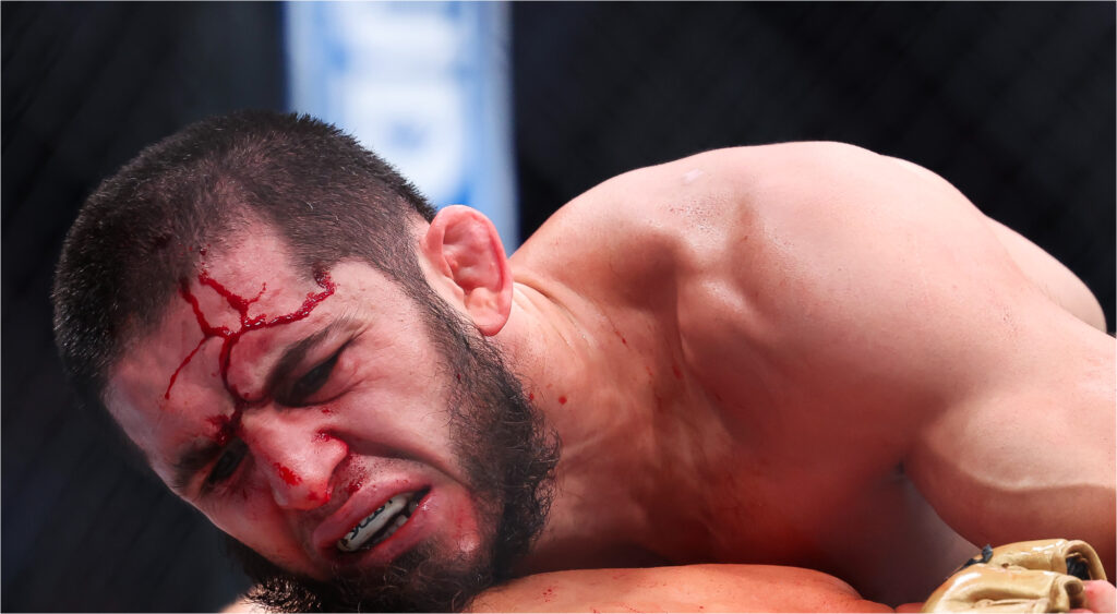 Islam Makhachev reveals injured hand