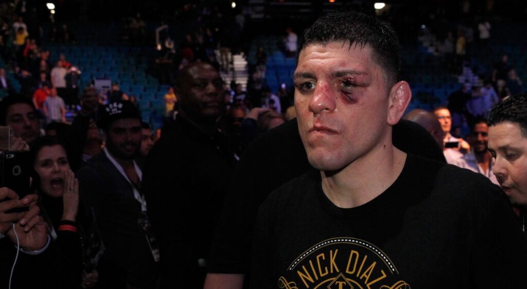 Nick Diaz leaves the arena after losing to Anderson Silva 