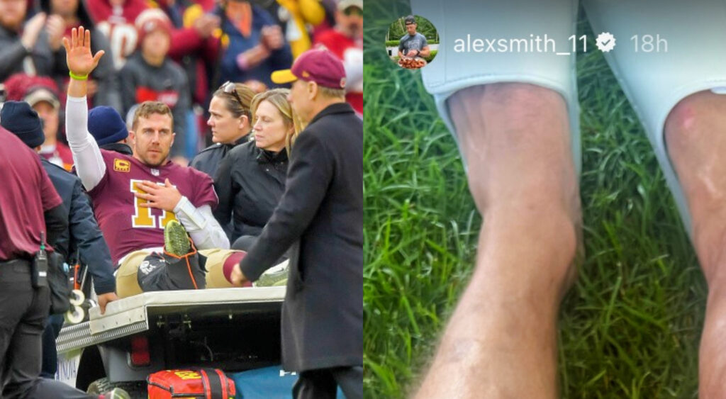 Alex Smith Makes Crude Joke While Posting Nasty Image Of His Surgically Repaired Leg