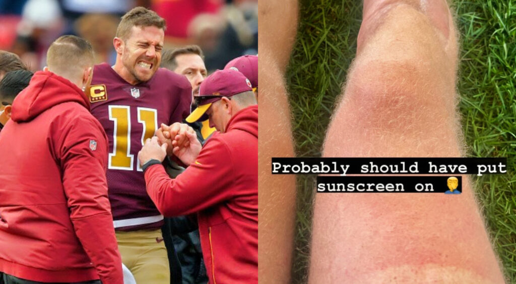 Everyone Said The Same Thing About New Image Of Alex Smith's Surgically Repaired Right Leg