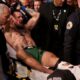 Conor McGregor Injury