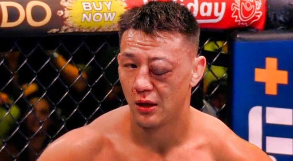 Rong Zhu gets elbowed in the eye