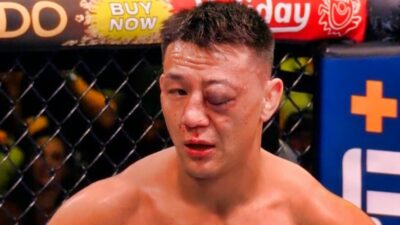 Rong Zhu gets elbowed in the eye