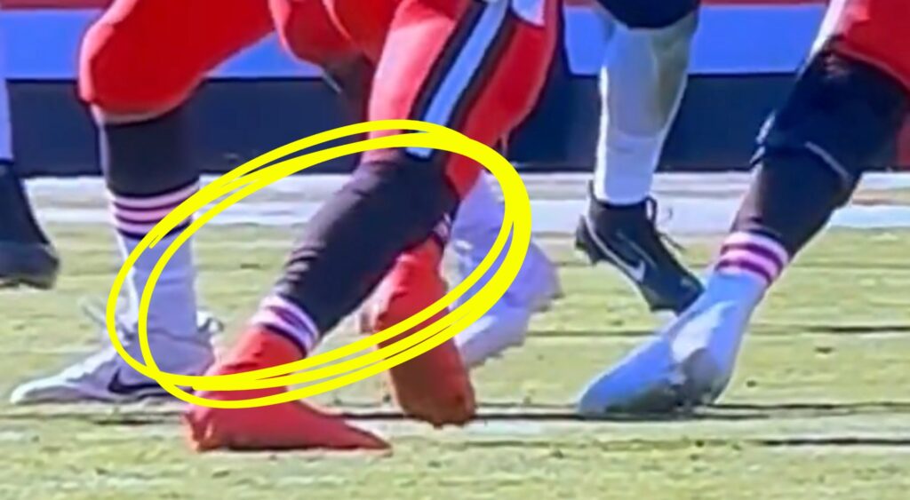 Deshaun Watson's achilles popping close up.