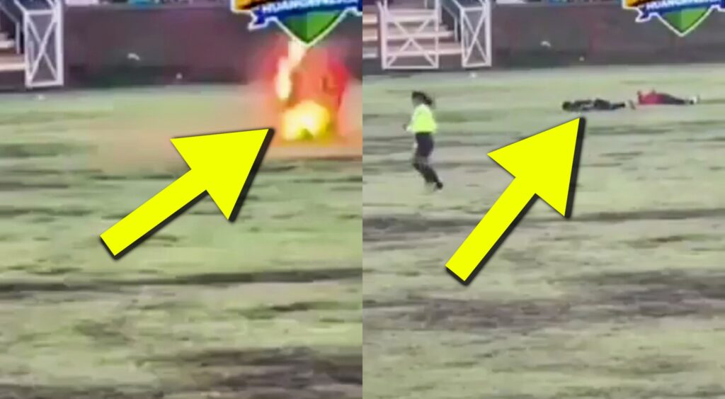 Peruvian soccer player struck by lightning.