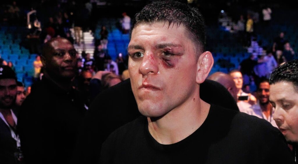 Nick Diaz: From Entertaining Fighter to Troubling Times