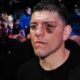 Nick Diaz: From Entertaining Fighter to Troubling Times