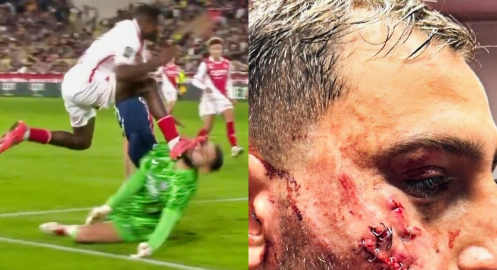 Gianluigi Donnarumma getting kicked in the face and the aftermath.