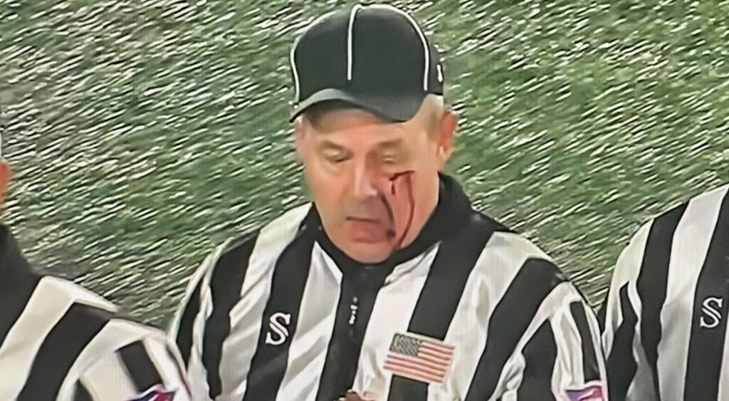 Ref cut and bleeding.